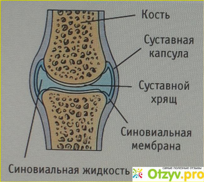 Отзыв о Артроз. Причины. Лечение.