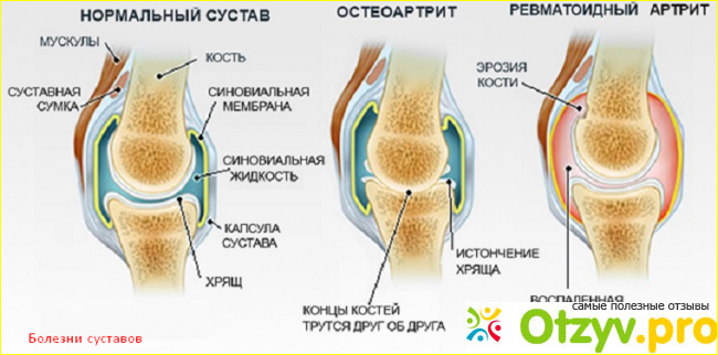 Отзывы