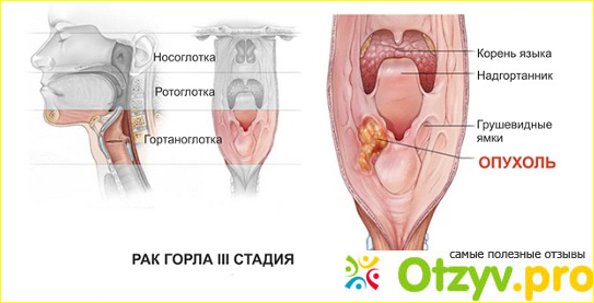 Бризантин где купить и сколько стоит