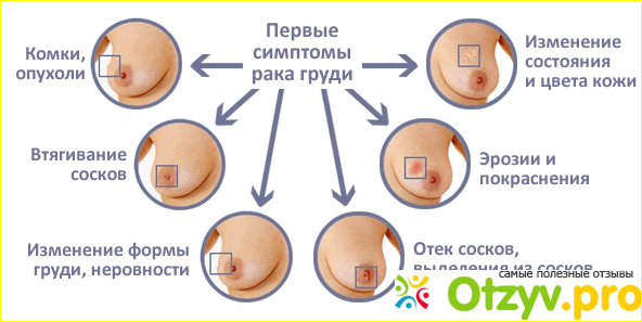 Онкоцитология