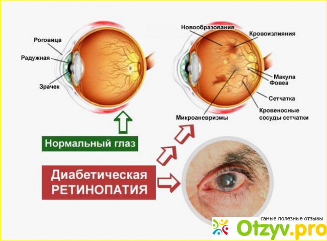 Инструкция по применению