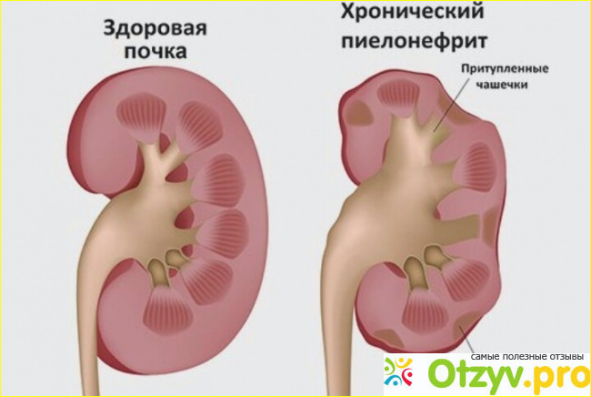 Отзыв о Щелочная фосфатаза норма