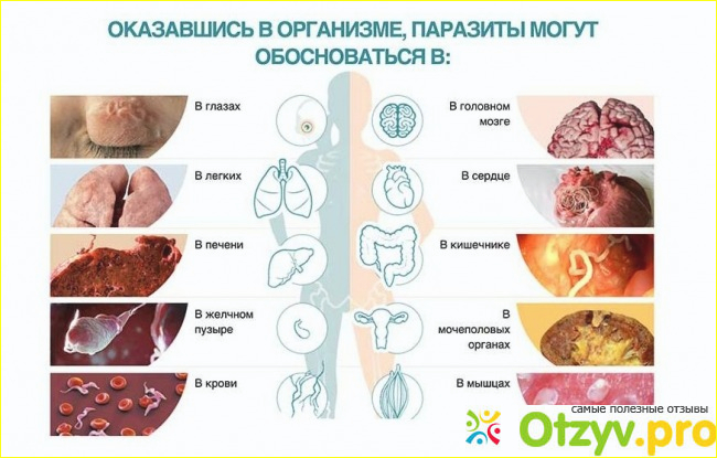 Врач посоветовал пропить курс Нотоксина.