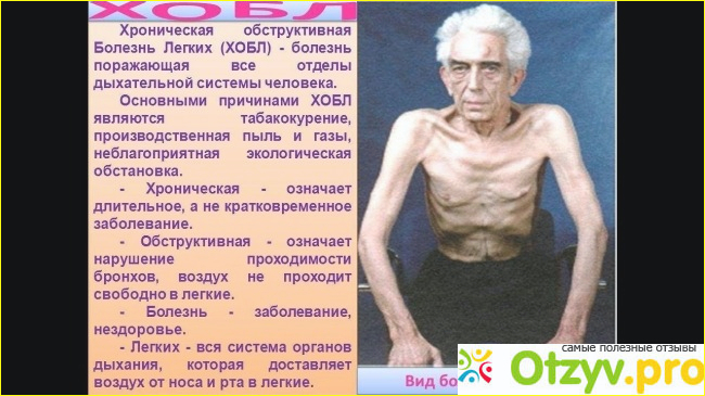 Симптомы.