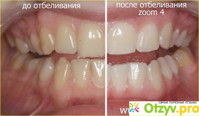 Подготовка.