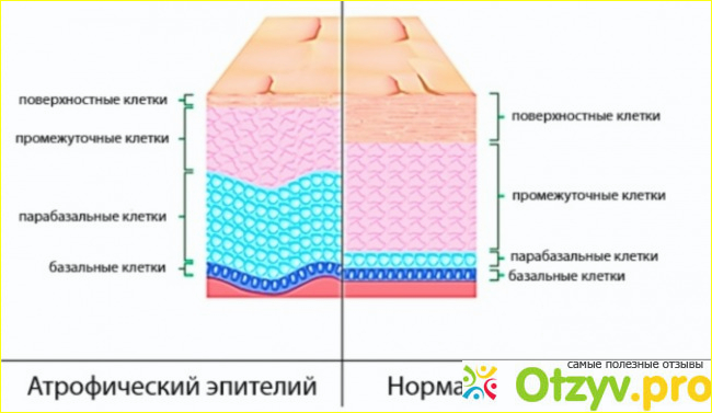 Варианты лечения. 