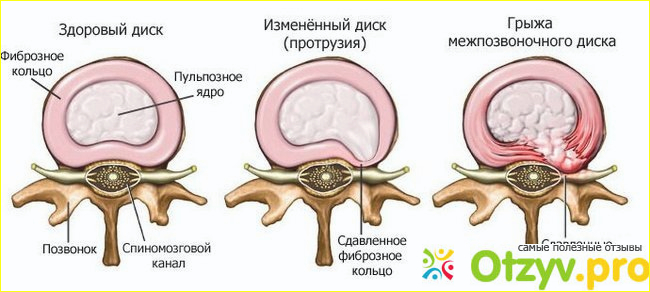 Профилактика