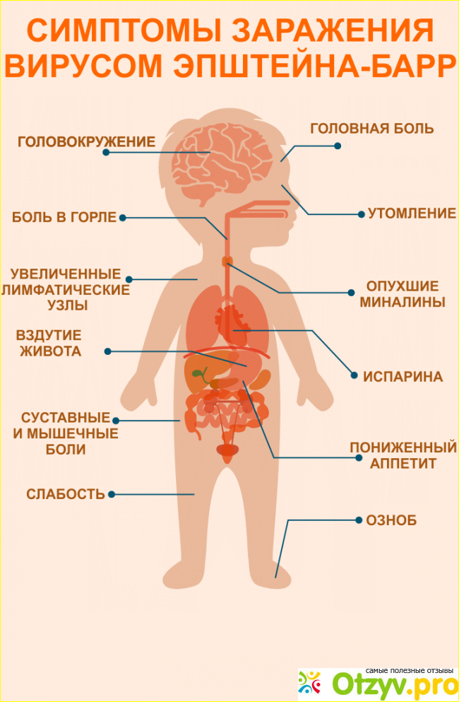 Имеет ли вирус Эпштейна-Барра долгосрочные последствия 