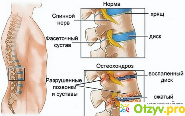 Побочные эффекты.