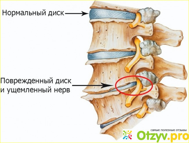 Лечебная физкультура