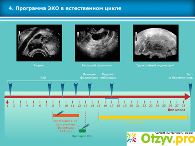 Отзывы эко в естественном цикле фото2