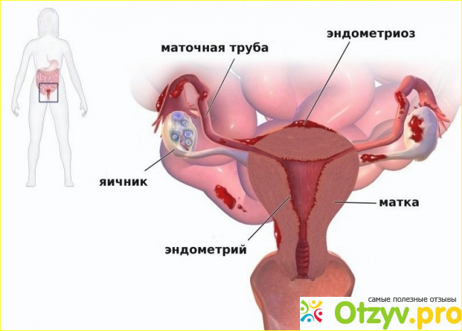 Какие показания к применению.