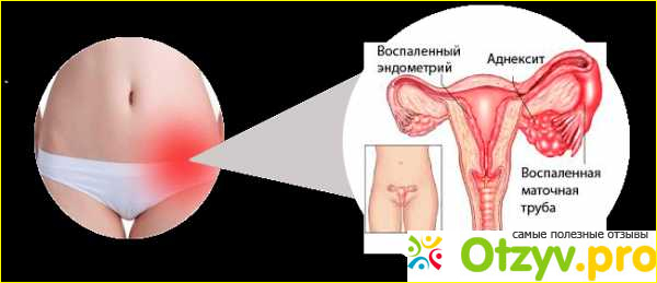 Личный опыт