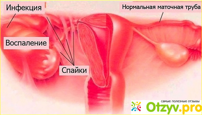 Симптомы и как лечить