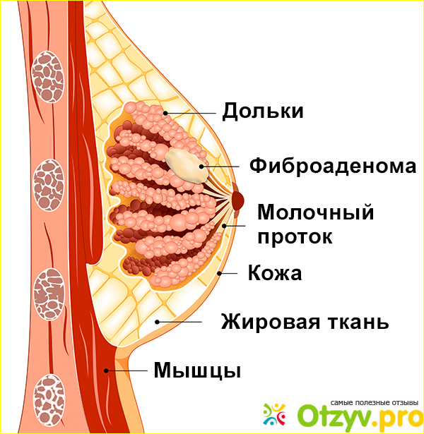 Немного о своем диагнозе