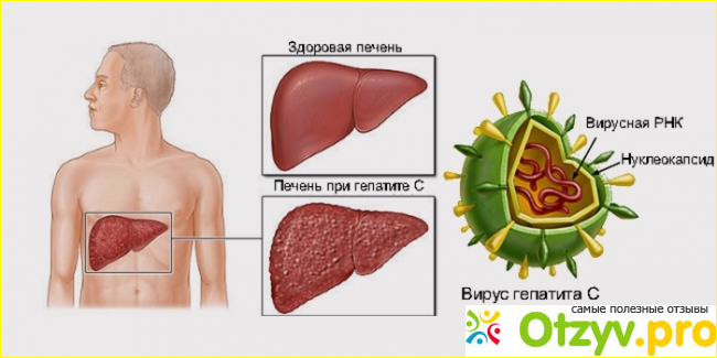 Суть