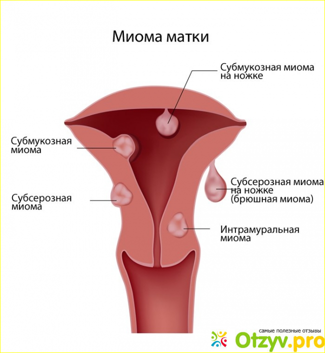 Результаты и выводы