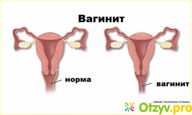 Цена, где купить, аналоги