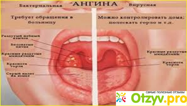 Тонзилотрен инструкция по применению цена отзывы аналоги фото2