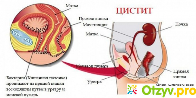 Растительные средства.