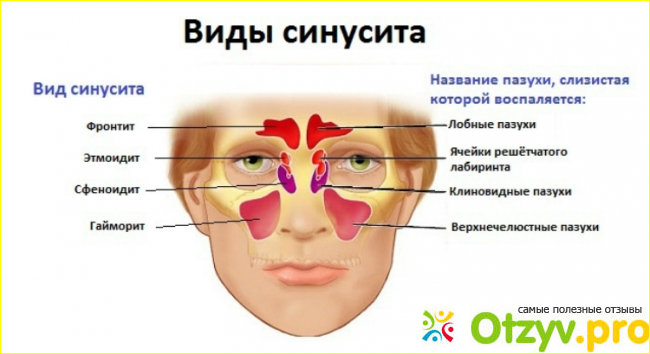 Симптоматика хронической формы течения данного заболевания.