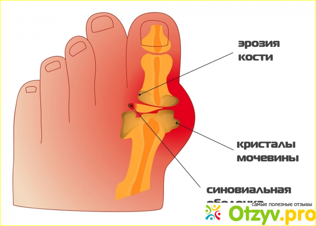 Опыт применения