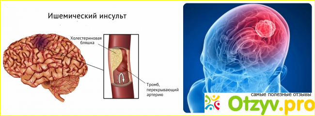 Показания: