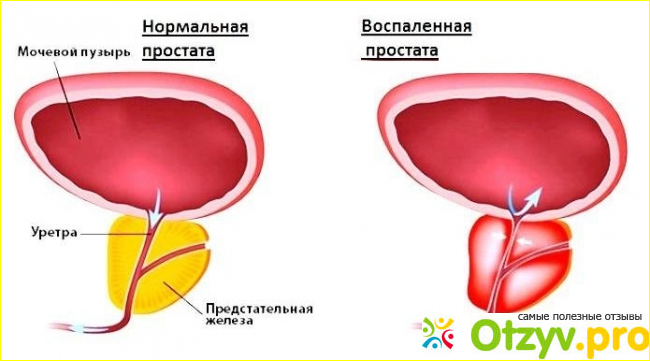 Menurin отзывы фото1