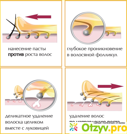 Отзыв о Шугаринг (сахарная эпиляция) в домашних условиях