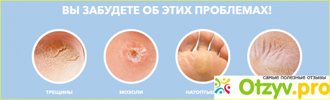 Электрическая пемза для педикюра Pedi Spin отзывы