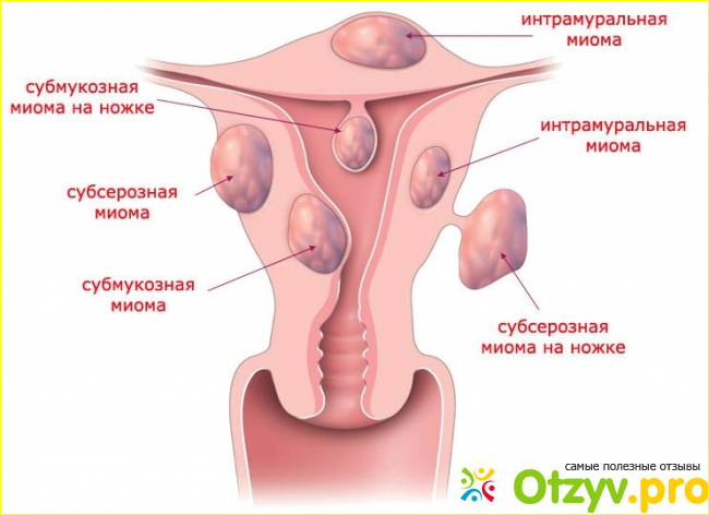 Что представляет собой данное заболевание? 