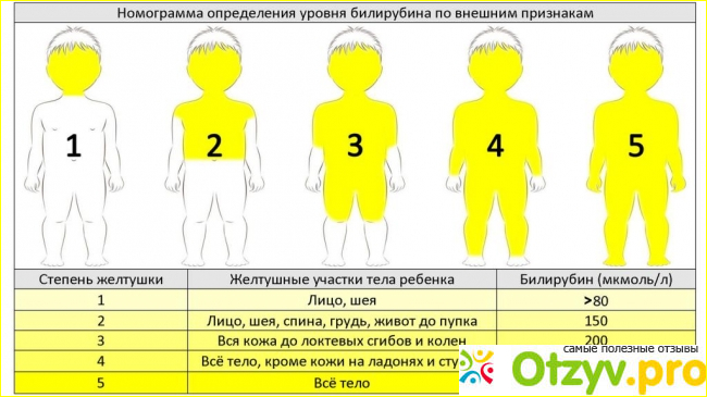 Чем опасен высокий уровень билирубина.