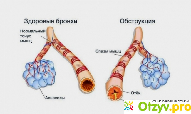Итоги