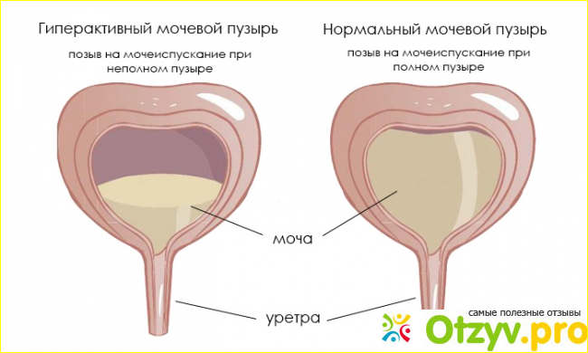 Заключение.