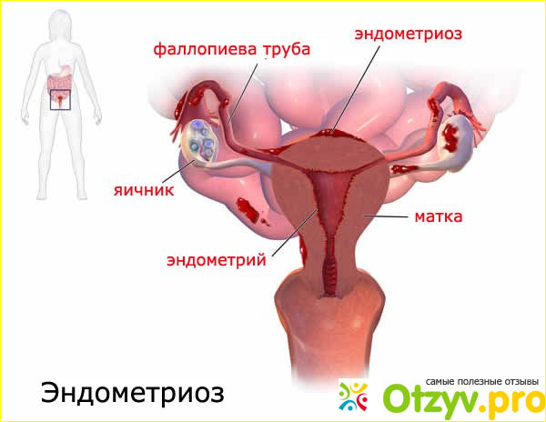 В каком возрасте возникает данное заболевание?