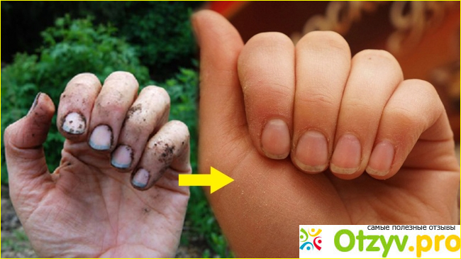 Отзыв о Как очистить руки после грязи или приготовлении красящих продуктов.