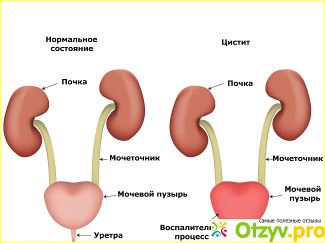 Мой опыт