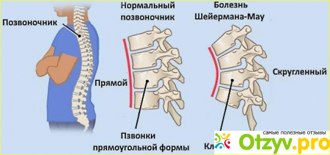 Лечение.