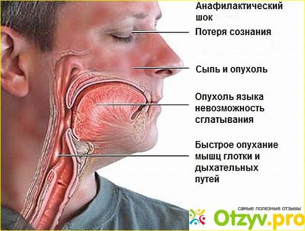 Основные противопоказания к применению данного лекарственного препарата 