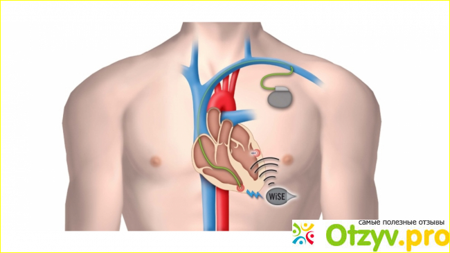 Ems trainer отзывы реальных покупателей фото2