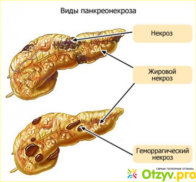 Прогноз после перенесённой операции.