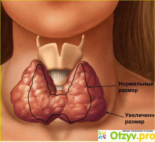 Отзывы пациентов.