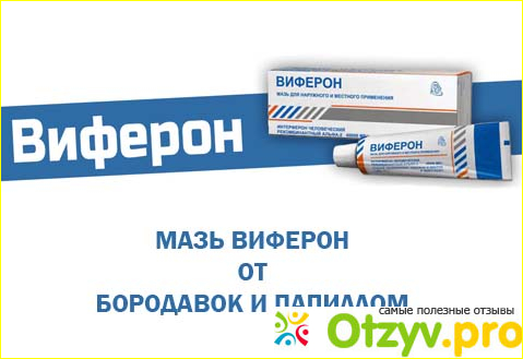 Отзыв.