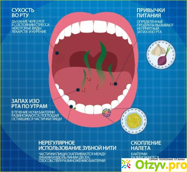 5. Прекращаем питься пищей, провоцирующей запах. 