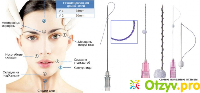 Проведение процедуры.