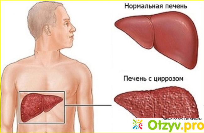 Отклики пациентов. 