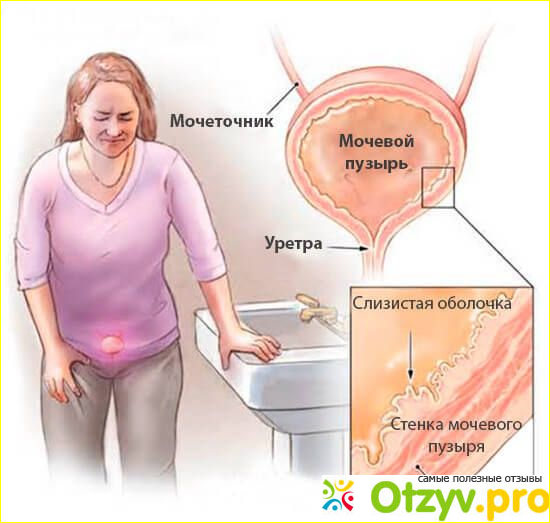 Есть ли прививка от инфекции мочевого пузыря?