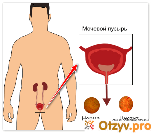 Причины.