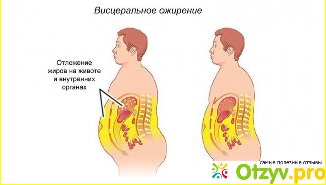  Отзывы худеющих 2018 года.