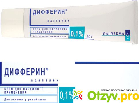 Отзывы покупателей. 